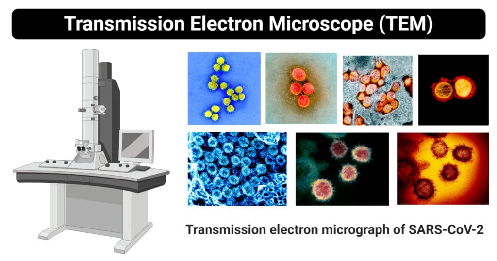 Transmission Electron Microscope (TEM) Definition, Principle, Images