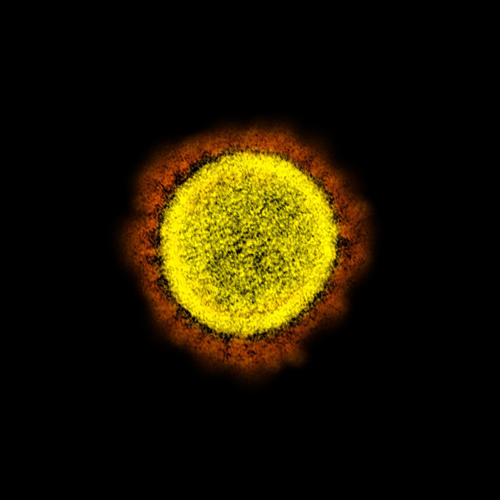 15. Transmission electron micrograph of SARS-CoV-2