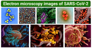 Electron microscopy images of SARS-CoV-2