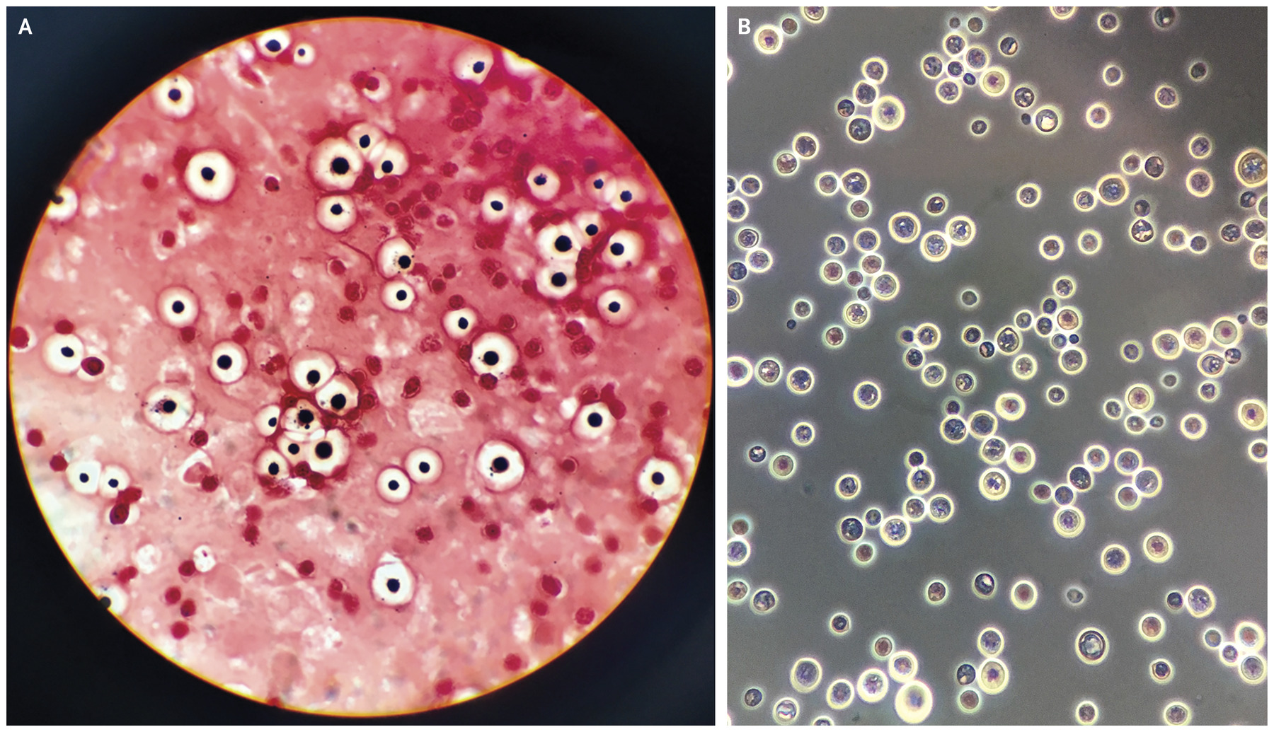 Cryptococcus neoformans- An Overview