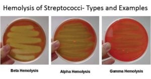 Hemolysis of Streptococci- Types and Examples with Images
