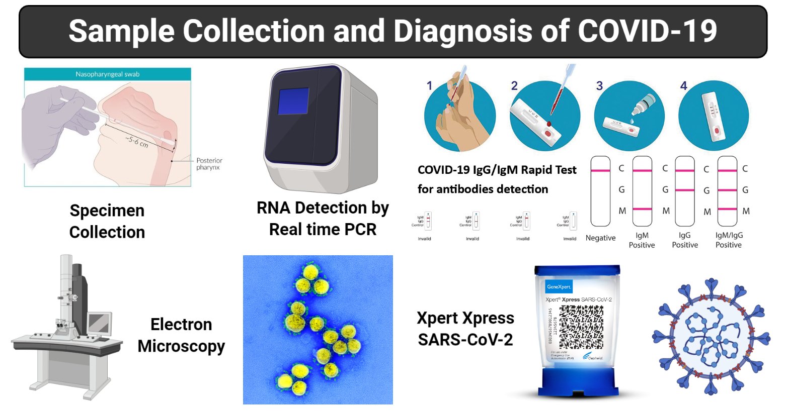 Sample collection and Diagnosis of COVID-19