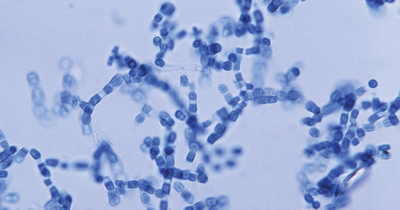 Arthroconidia of Coccidioides- Coccidioidomycosis