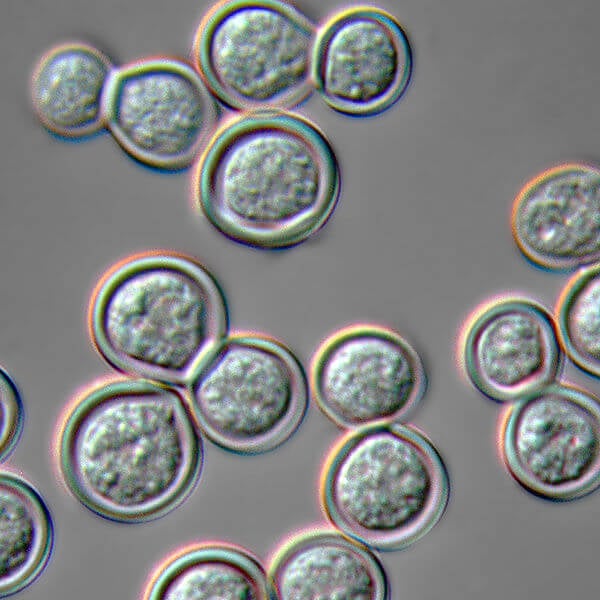 Blastomyces dermatitidis yeast form cultured on blood agar at 37 C and photographed in Nomarski Differential Interference Contrast microscopy.