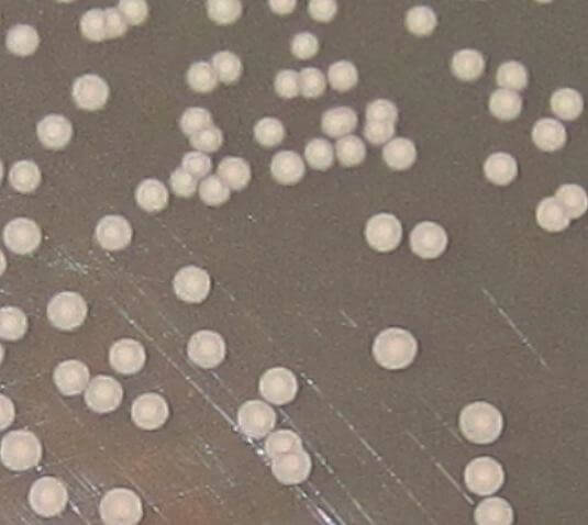 Candida parapsilosis- Pink colored colonies on Hicrome agar
