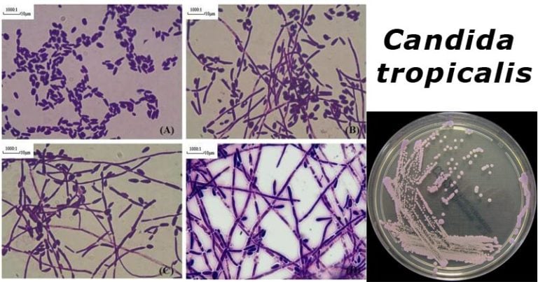 candida-tropicalis-an-overview