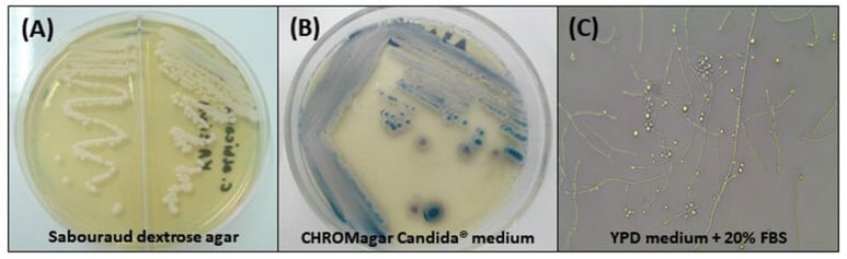 Cultural Characteristics of Candida tropicalis