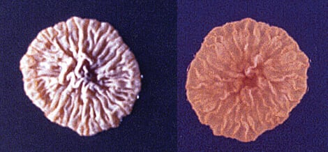 Culture of Microsporum ferrugineum