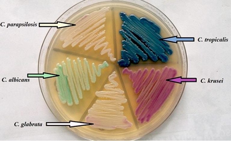 Does Candida Glabrata Need To Be Treated