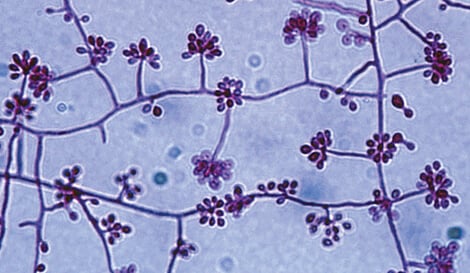 Sporothrix schenckii conidiophores and conidia