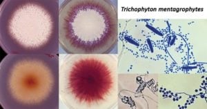 Trichophyton mentagrophyte
