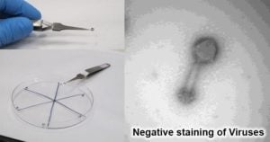 Negative staining of Viruses