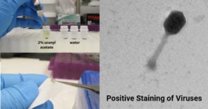 Positive staining of Viruses