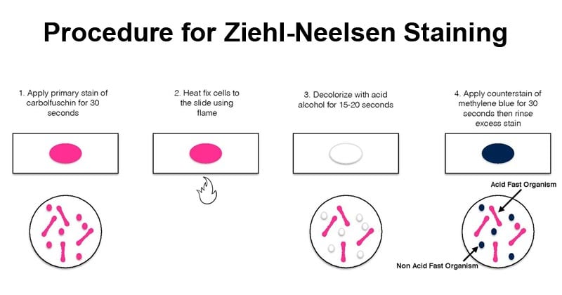 Procedure for Ziehl-Neelsen Staining