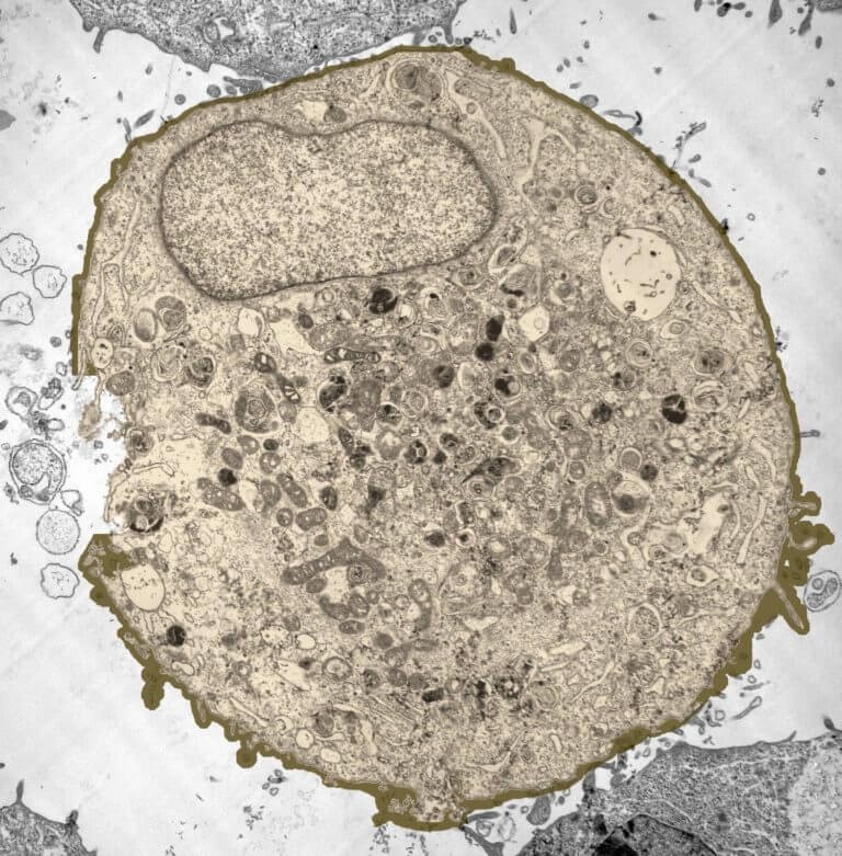 human cell under electron microscope