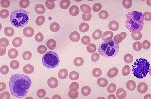 Blood cells under the microscope