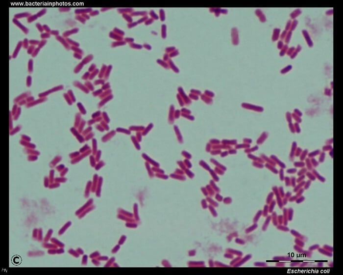 E. coli under the microscope