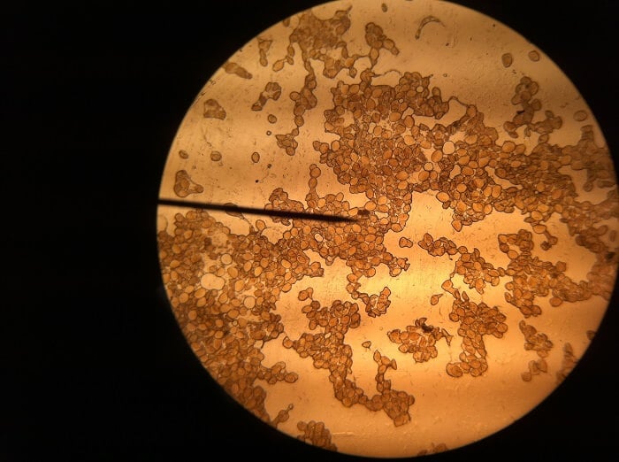 Pollen under the microscope