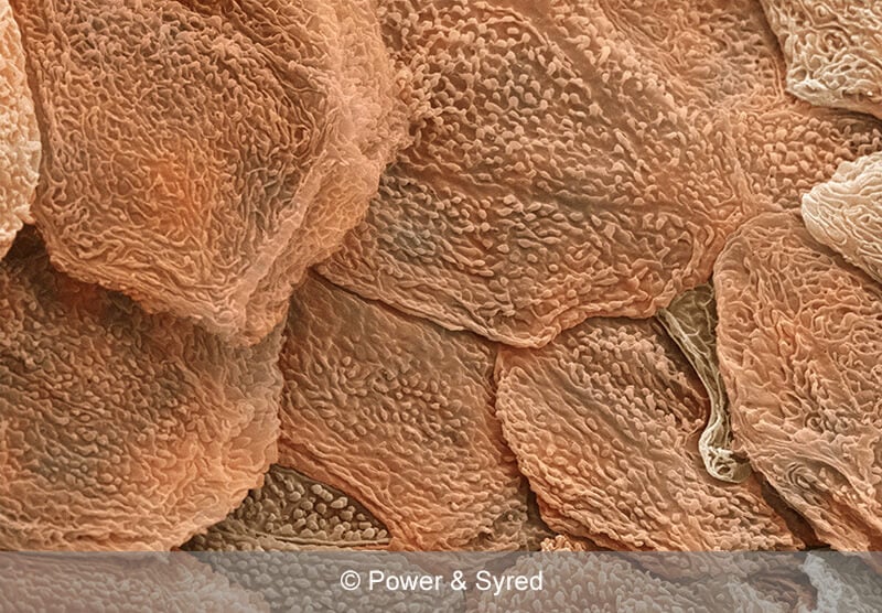 Skin under the microscope
