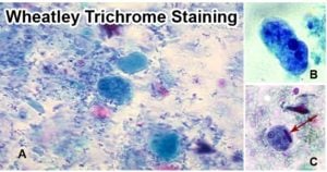 Wheatley Trichrome Staining