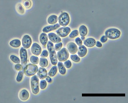 Yeast under microscope