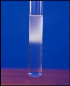 Emulsion test for Lipids