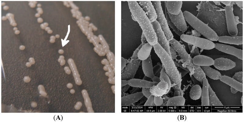 Candida parapsilosis on sale