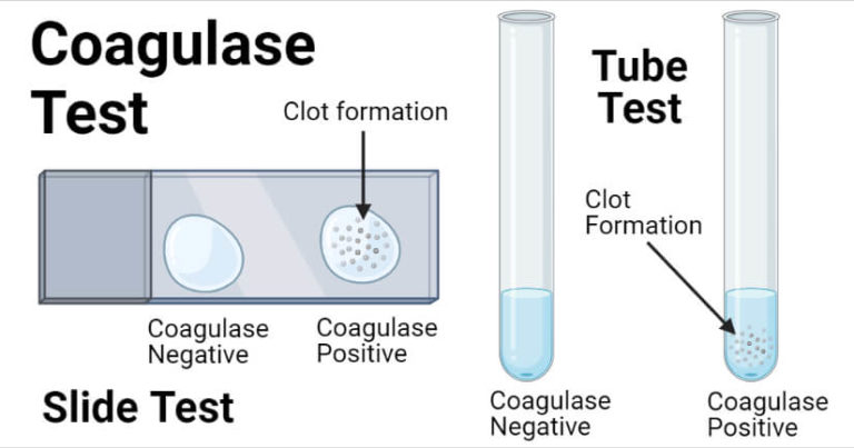 Coagulase Test Principle Procedure Types Result Uses