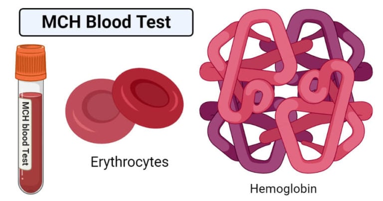 mch-blood-test-definition-calculation-results-high-and-low-mch-value