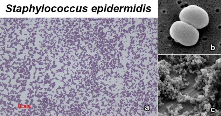 Staphylococcus Epidermidis An Overview Microbe Notes 