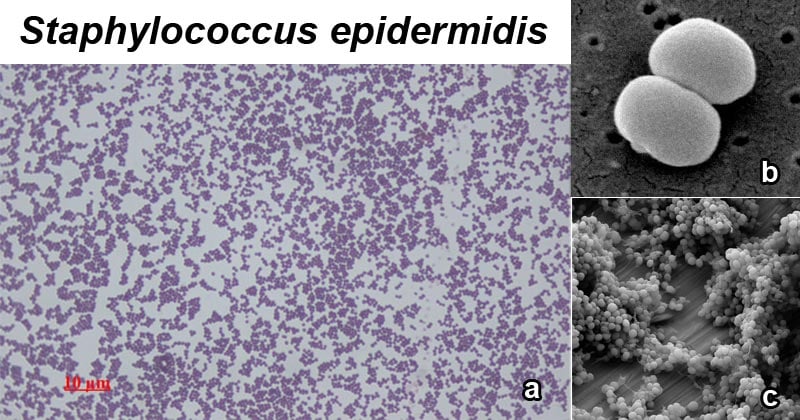Staphylococcus epidermidis - An Overview