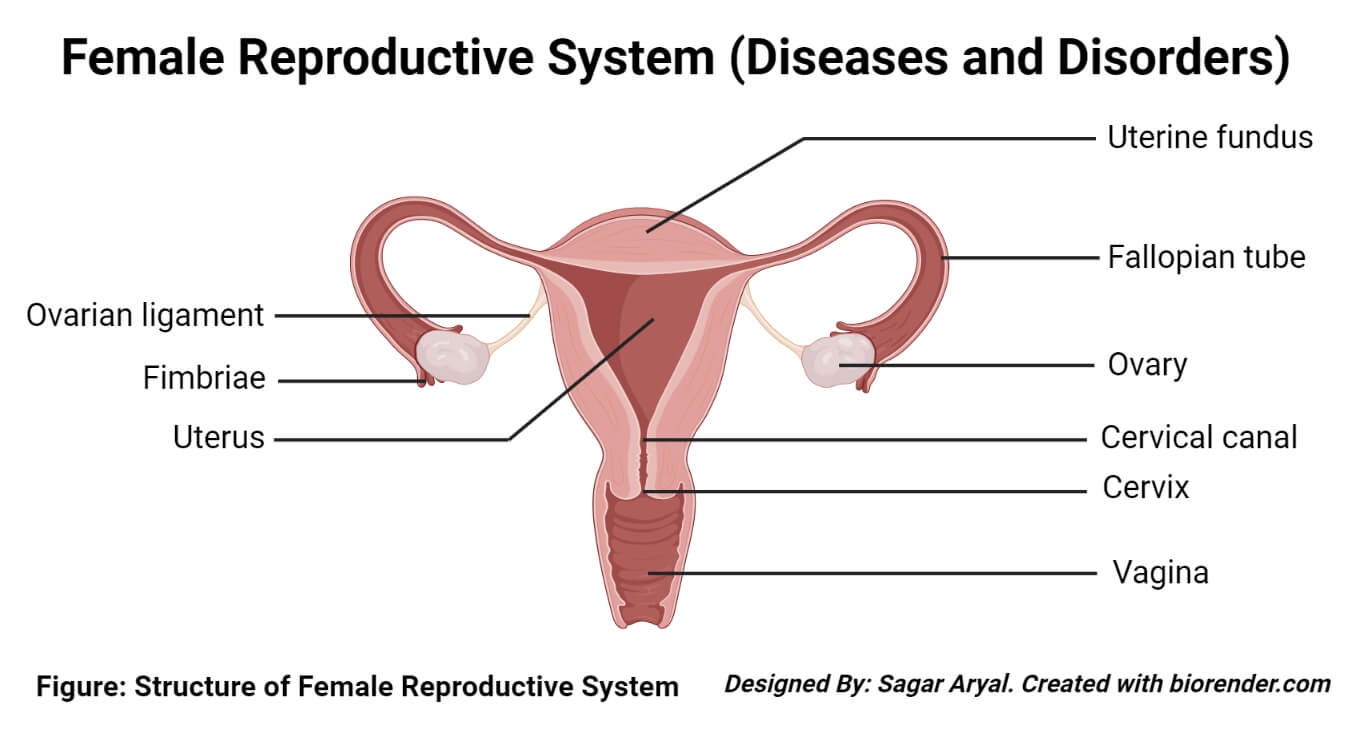 Diseases and Disorders of the female reproductive system