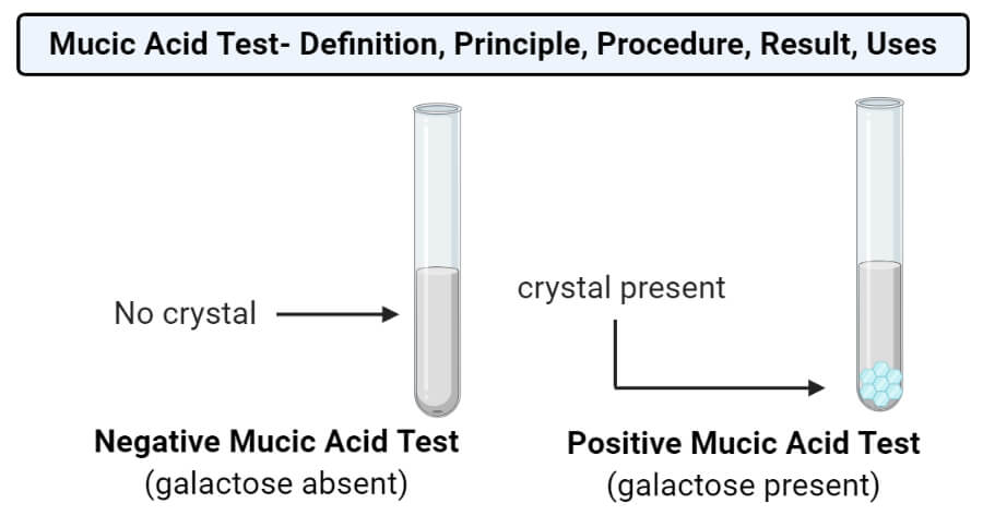 Mucic Acid Test