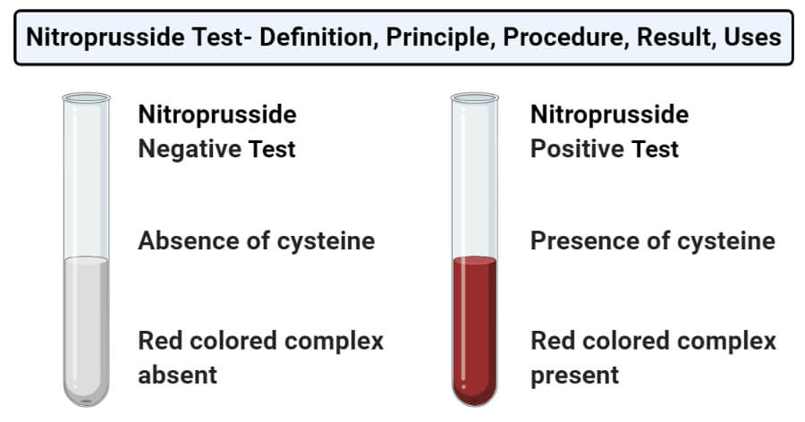 Nitroprusside Test