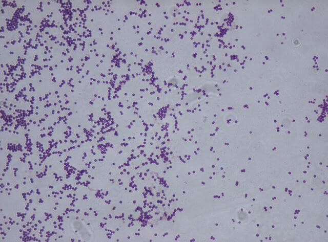 Gram Staining of Staphylococcus saprophyticus