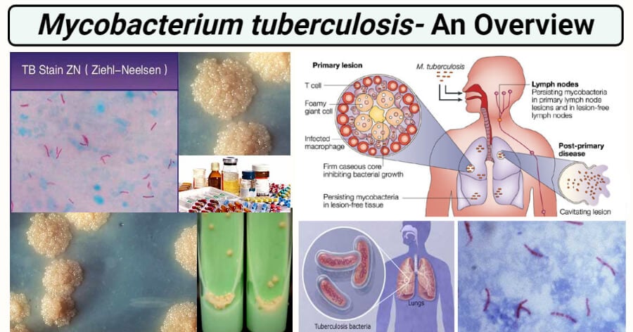 Mycobacterium tuberculosis