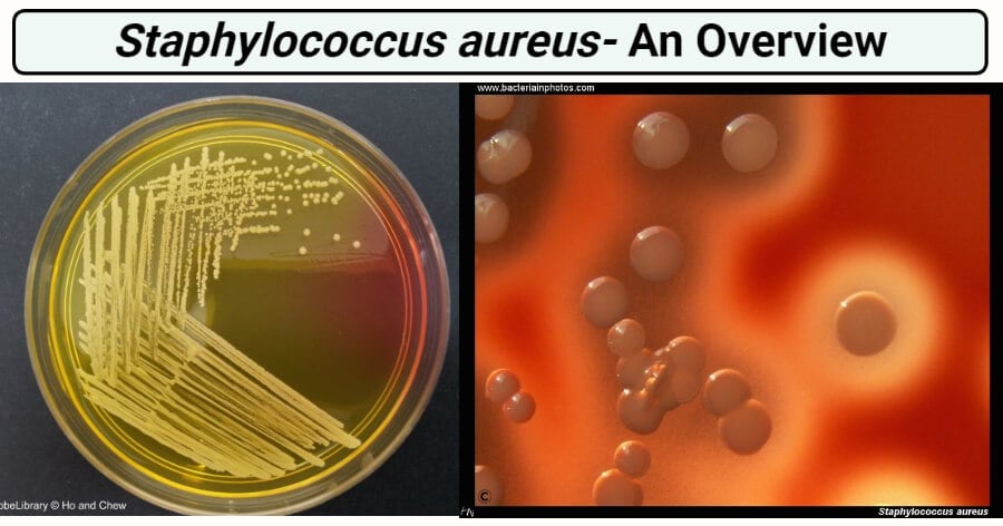 importance of staphylococcus aureus