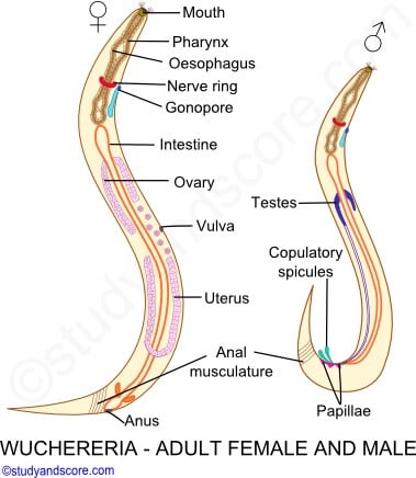 Wuchereria bancrofti Adult Worm