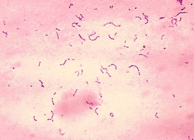 Streptococcus mutans gram stain