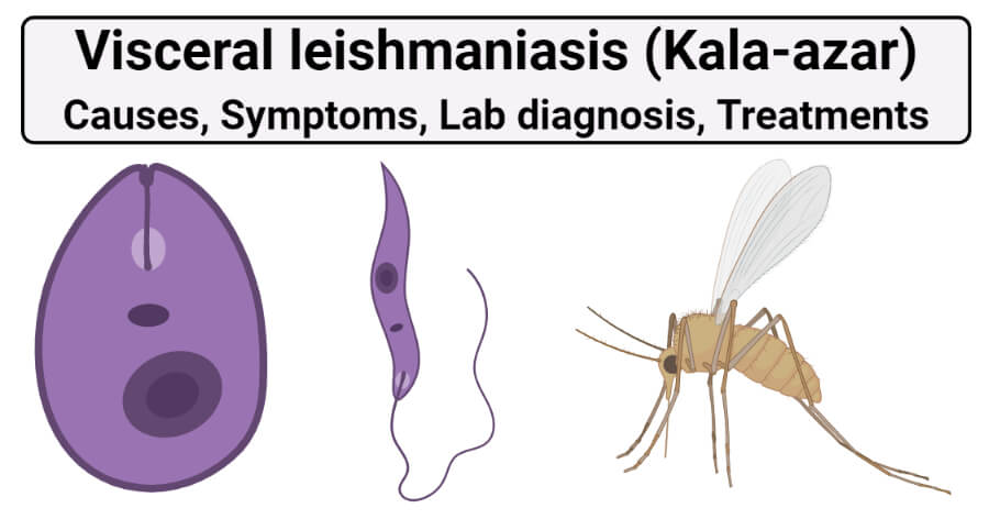 Visceral leishmaniasis (Kala-azar)