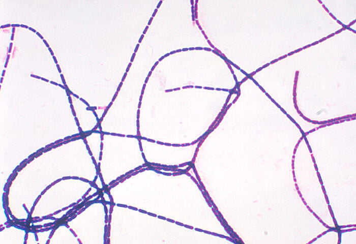Bacillus anthracis gram stain