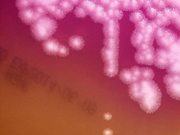 Bacillus anthracis on mannitol, egg yolk, polymyxin agar (MEP)