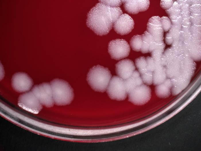 Bacillus anthracis on sheep blood agar (SBA)