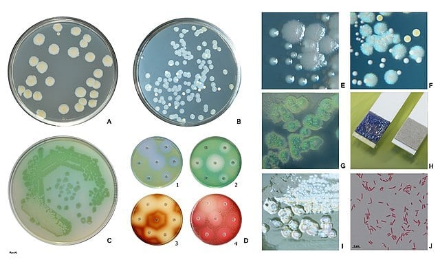 Biochemical Characteristics of Pseudomonas aeruginosa