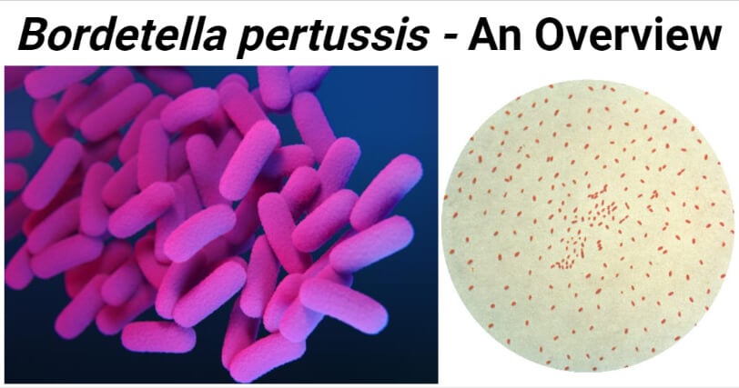Bordetella pertussis An Overview  Microbe Notes
