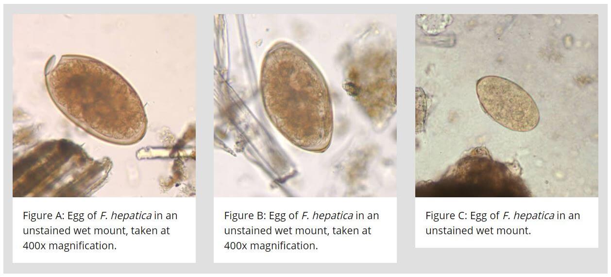 Eggs- Morphology of Fasciola hepatica