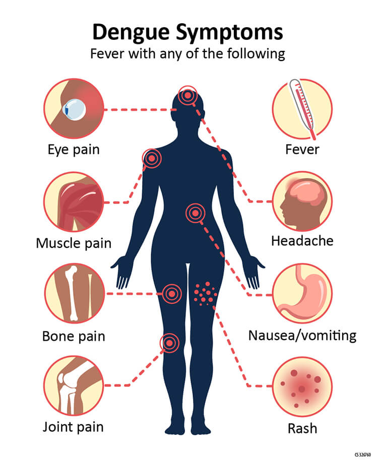 Clinical Manifestations of Dengue