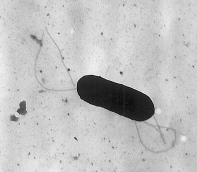Electron micrograph of a flagellated Listeria monocytogenes bacterium