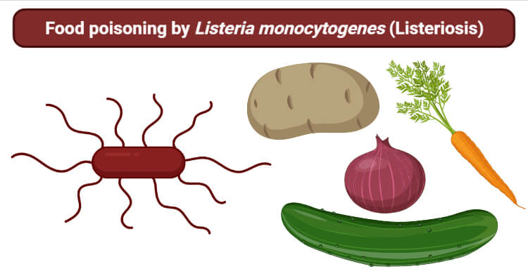 Food poisoning by Listeria monocytogenes (Listeriosis)