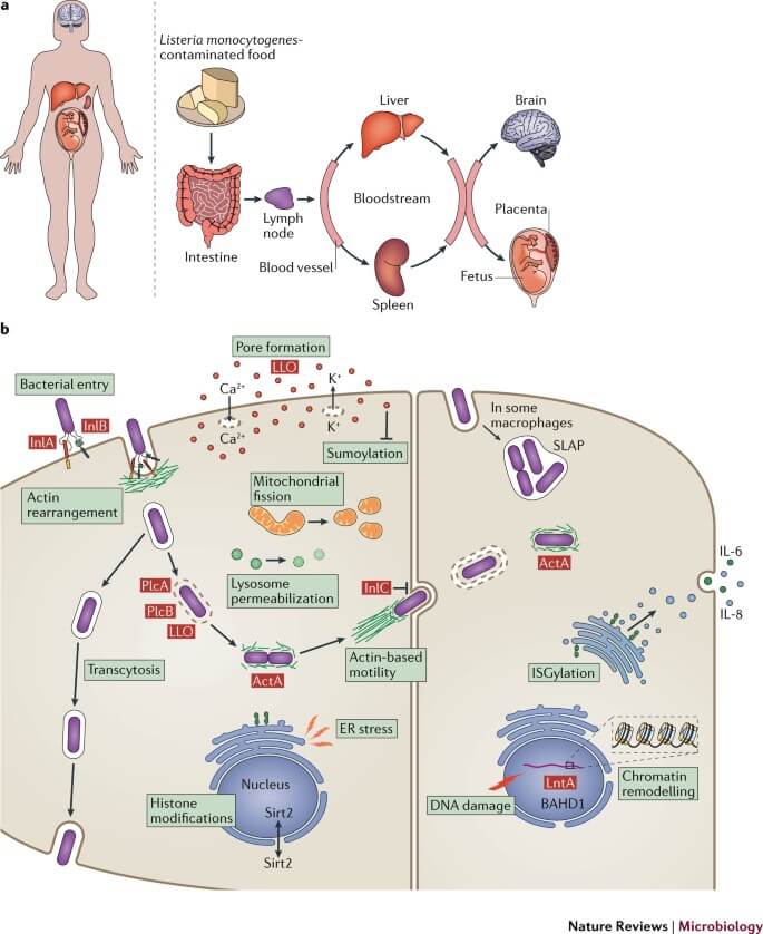 Overview of Listeria monocytogenes infection